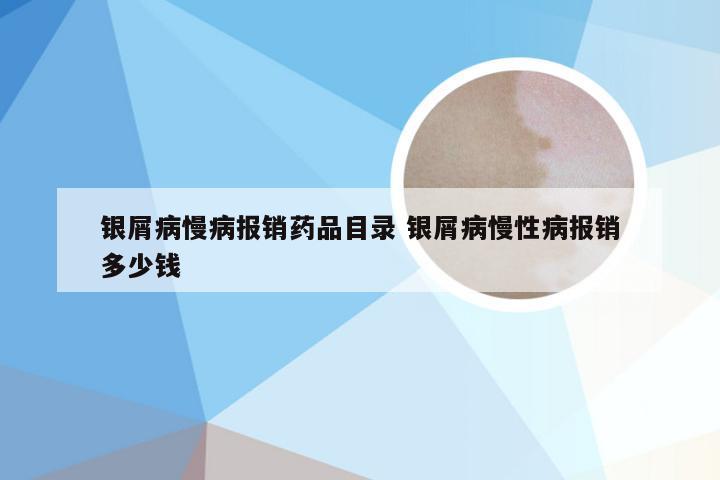 银屑病慢病报销药品目录 银屑病慢性病报销多少钱
