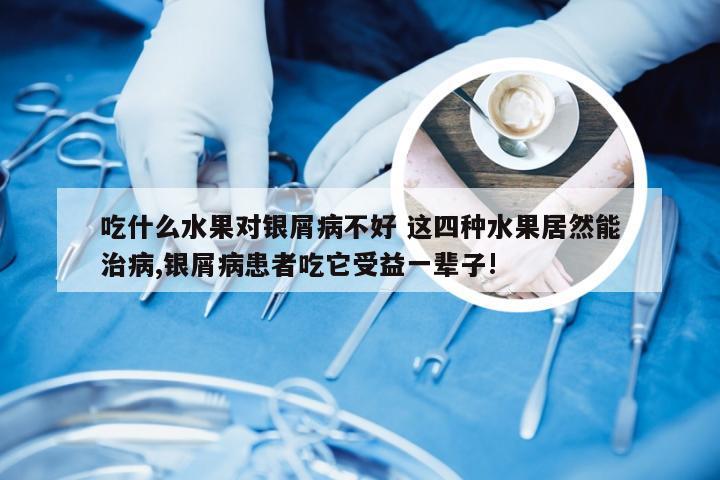 吃什么水果对银屑病不好 这四种水果居然能治病,银屑病患者吃它受益一辈子!