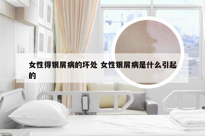 女性得银屑病的坏处 女性银屑病是什么引起的