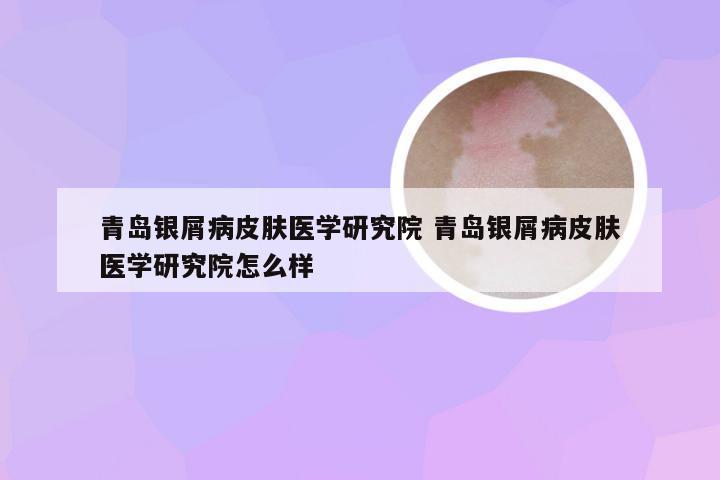 青岛银屑病皮肤医学研究院 青岛银屑病皮肤医学研究院怎么样