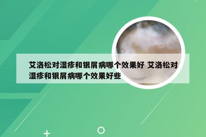 艾洛松对湿疹和银屑病哪个效果好 艾洛松对湿疹和银屑病哪个效果好些