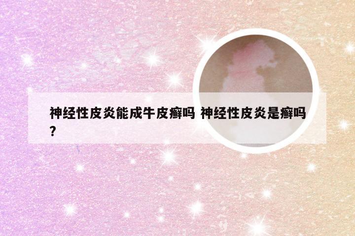 神经性皮炎能成牛皮癣吗 神经性皮炎是癣吗?