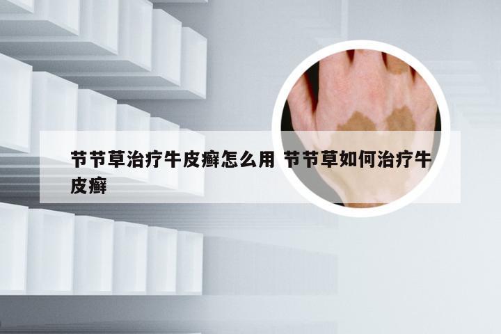 节节草治疗牛皮癣怎么用 节节草如何治疗牛皮癣