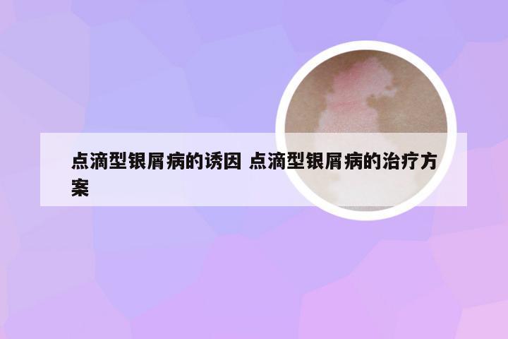 点滴型银屑病的诱因 点滴型银屑病的治疗方案