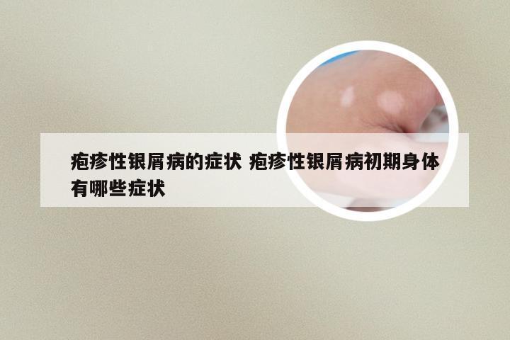 疱疹性银屑病的症状 疱疹性银屑病初期身体有哪些症状