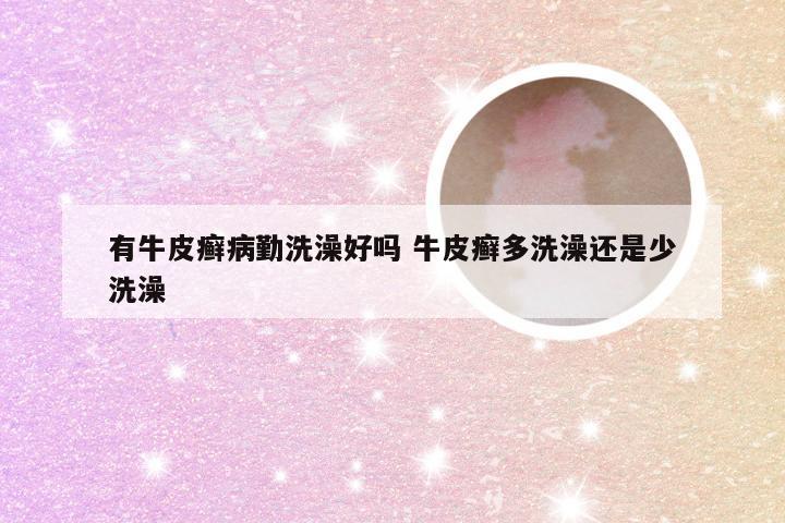 有牛皮癣病勤洗澡好吗 牛皮癣多洗澡还是少洗澡