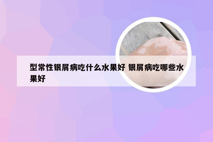 型常性银屑病吃什么水果好 银屑病吃哪些水果好