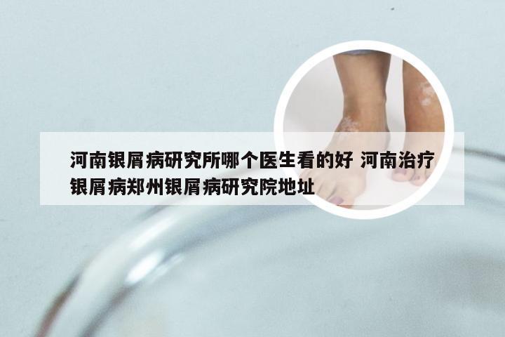 河南银屑病研究所哪个医生看的好 河南治疗银屑病郑州银屑病研究院地址
