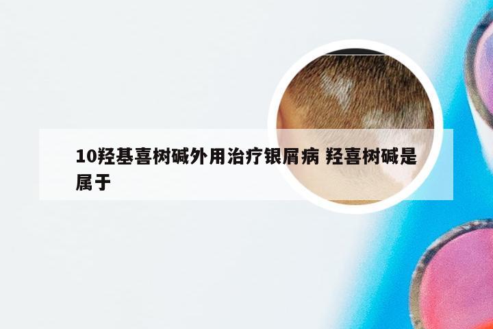 10羟基喜树碱外用治疗银屑病 羟喜树碱是属于