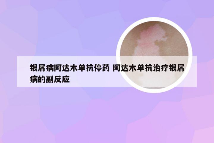 银屑病阿达木单抗停药 阿达木单抗治疗银屑病的副反应