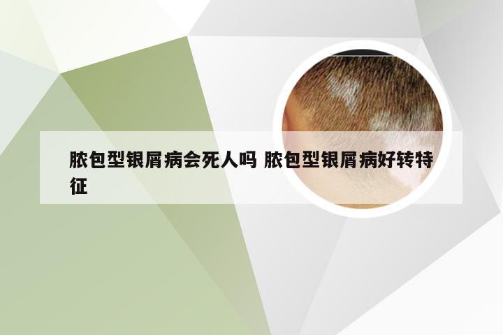 脓包型银屑病会死人吗 脓包型银屑病好转特征