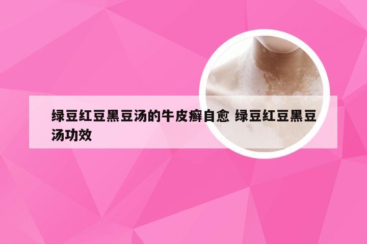 绿豆红豆黑豆汤的牛皮癣自愈 绿豆红豆黑豆汤功效