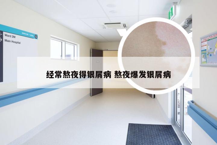 经常熬夜得银屑病 熬夜爆发银屑病