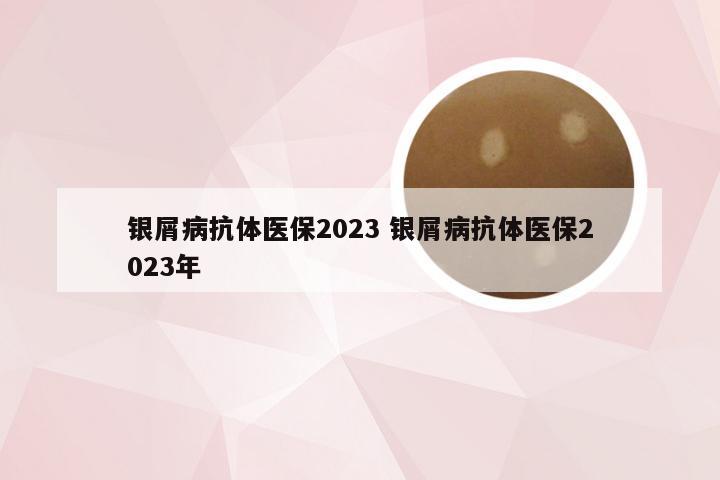 银屑病抗体医保2023 银屑病抗体医保2023年