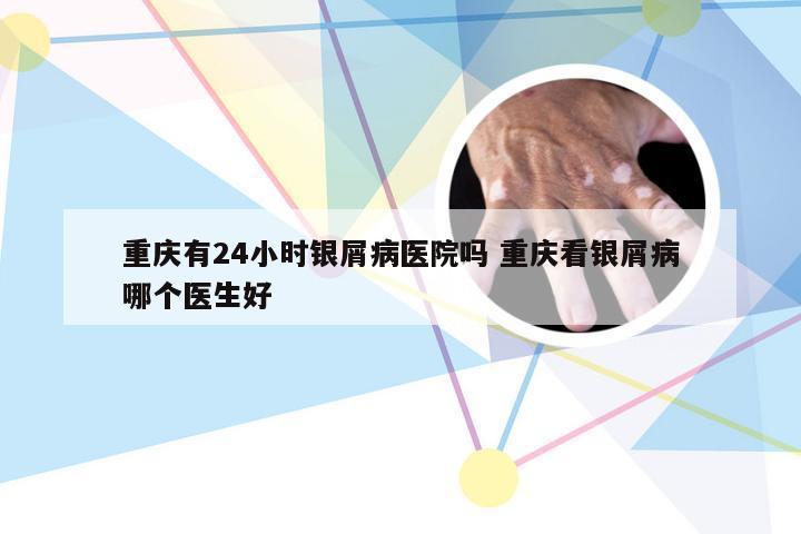 重庆有24小时银屑病医院吗 重庆看银屑病哪个医生好