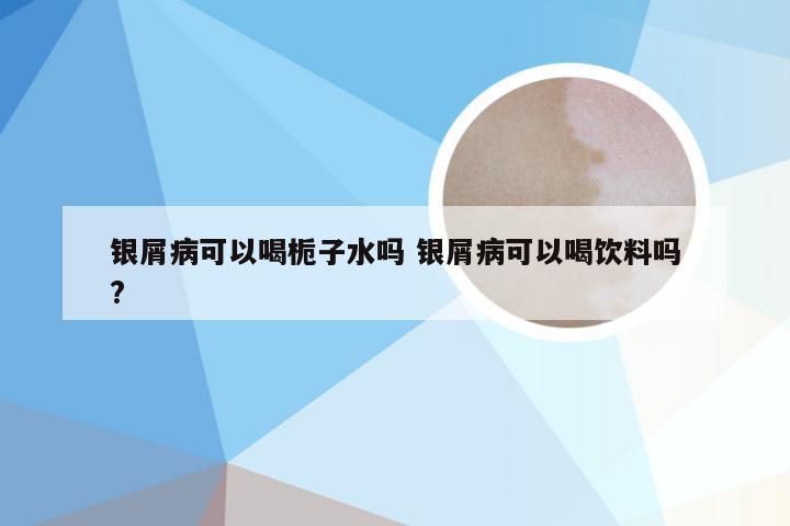 银屑病可以喝栀子水吗 银屑病可以喝饮料吗?
