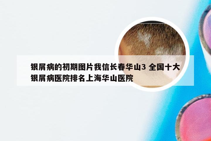银屑病的初期图片我信长春华山3 全国十大银屑病医院排名上海华山医院