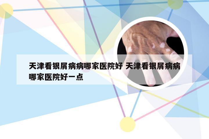 天津看银屑病病哪家医院好 天津看银屑病病哪家医院好一点