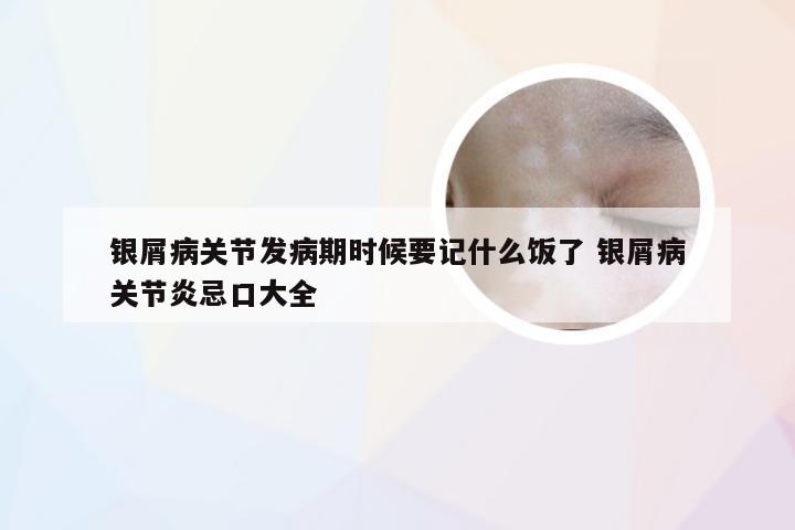 银屑病关节发病期时候要记什么饭了 银屑病关节炎忌口大全