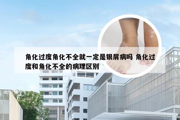 角化过度角化不全就一定是银屑病吗 角化过度和角化不全的病理区别