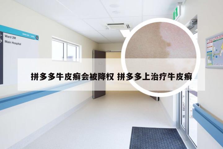 拼多多牛皮癣会被降权 拼多多上治疗牛皮癣