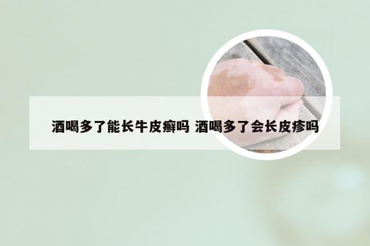 酒喝多了能长牛皮癣吗 酒喝多了会长皮疹吗