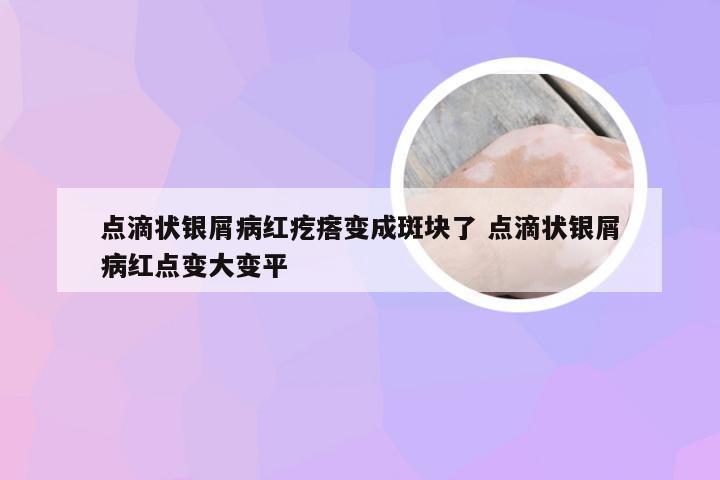 点滴状银屑病红疙瘩变成斑块了 点滴状银屑病红点变大变平