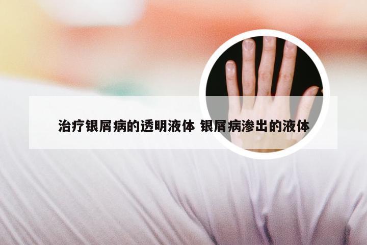 治疗银屑病的透明液体 银屑病渗出的液体