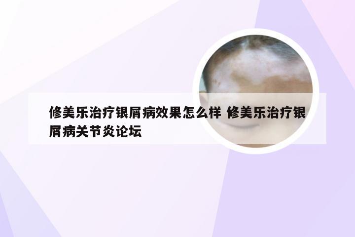 修美乐治疗银屑病效果怎么样 修美乐治疗银屑病关节炎论坛