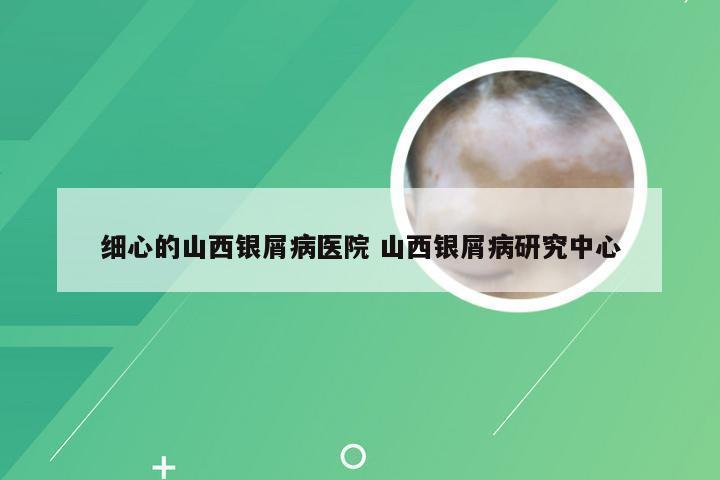 细心的山西银屑病医院 山西银屑病研究中心