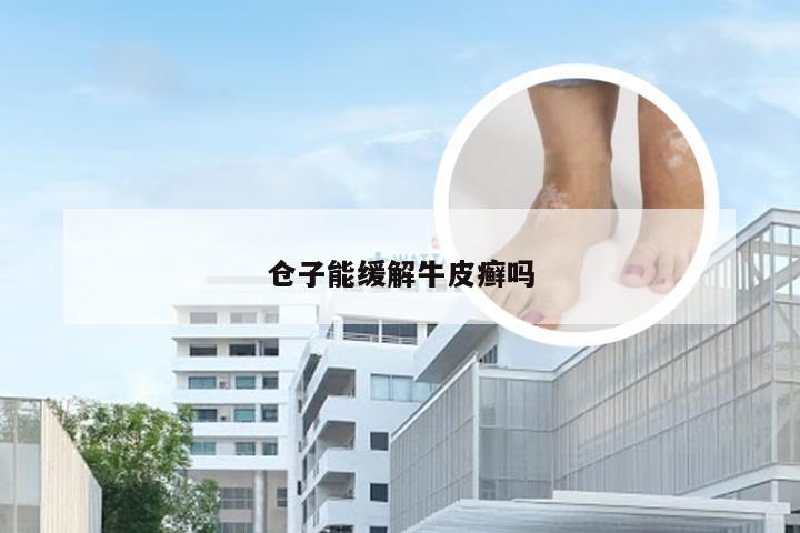仓子能缓解牛皮癣吗