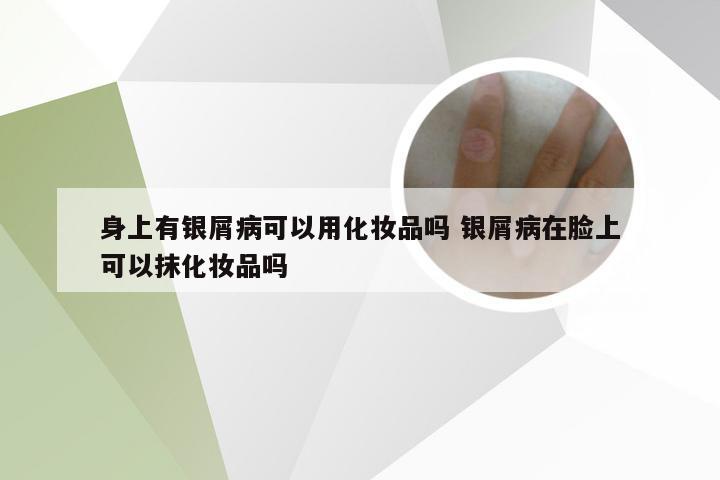身上有银屑病可以用化妆品吗 银屑病在脸上可以抹化妆品吗