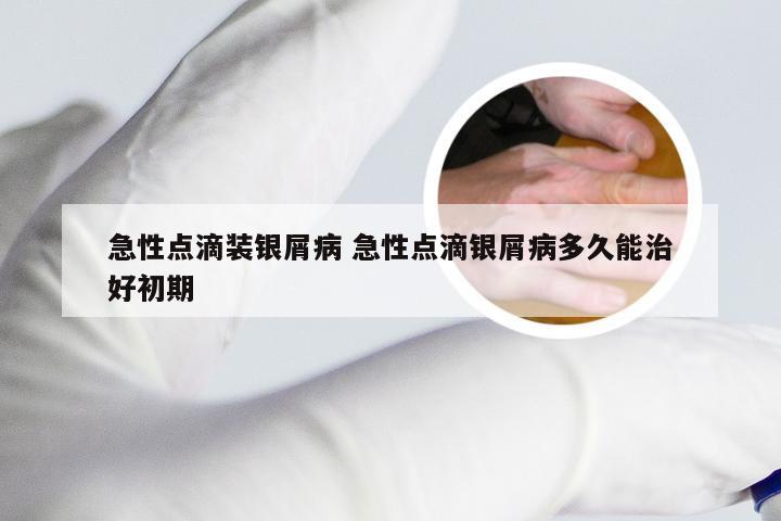 急性点滴装银屑病 急性点滴银屑病多久能治好初期