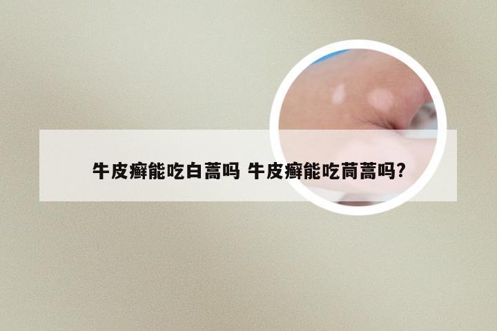 牛皮癣能吃白蒿吗 牛皮癣能吃茼蒿吗?