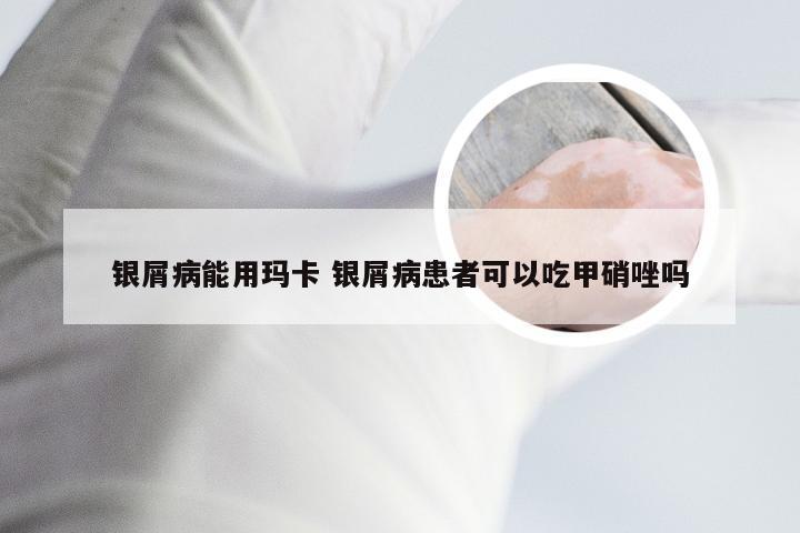 银屑病能用玛卡 银屑病患者可以吃甲硝唑吗