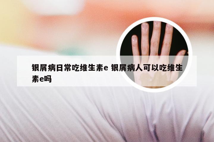 银屑病日常吃维生素e 银屑病人可以吃维生素e吗