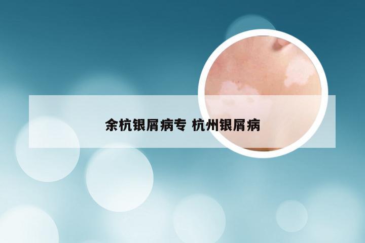 余杭银屑病专 杭州银屑病