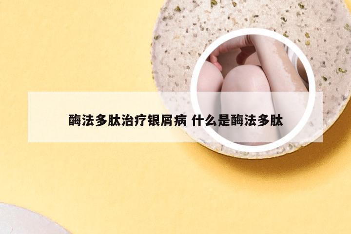 酶法多肽治疗银屑病 什么是酶法多肽