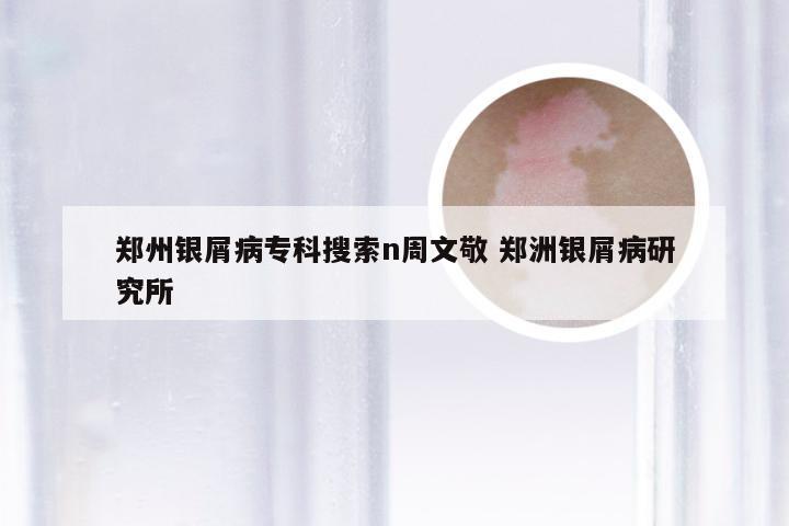 郑州银屑病专科搜索n周文敬 郑洲银屑病研究所