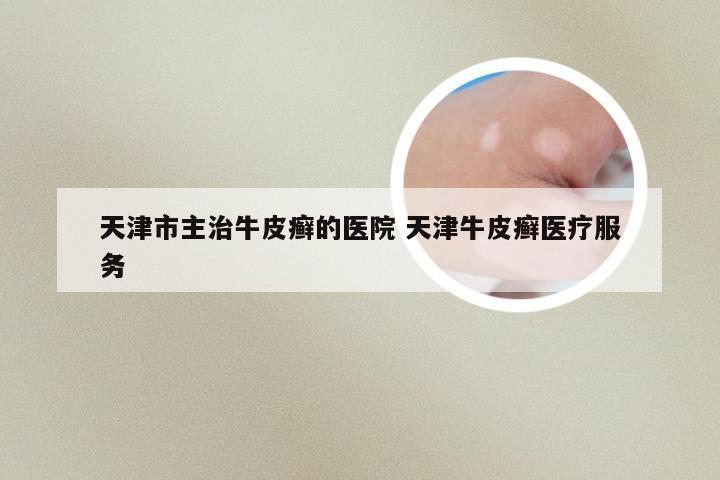 天津市主治牛皮癣的医院 天津牛皮癣医疗服务