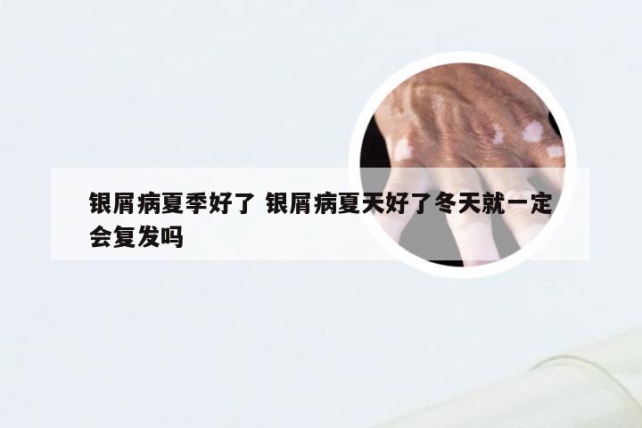 银屑病夏季好了 银屑病夏天好了冬天就一定会复发吗