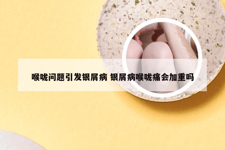 喉咙问题引发银屑病 银屑病喉咙痛会加重吗