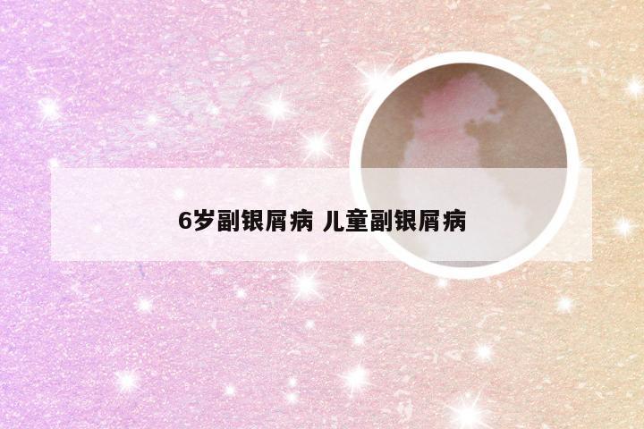 6岁副银屑病 儿童副银屑病