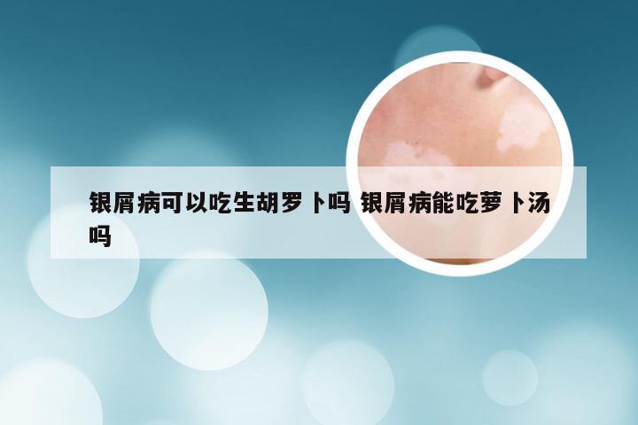 银屑病可以吃生胡罗卜吗 银屑病能吃萝卜汤吗