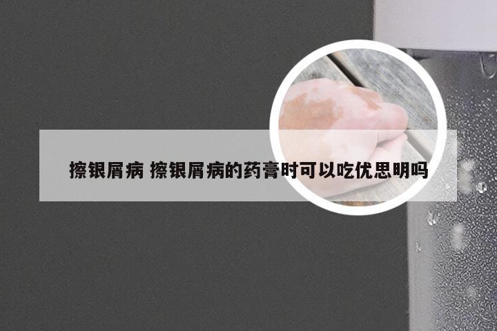 擦银屑病 擦银屑病的药膏时可以吃优思明吗