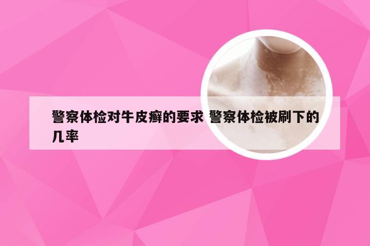 警察体检对牛皮癣的要求 警察体检被刷下的几率