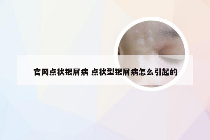 官网点状银屑病 点状型银屑病怎么引起的