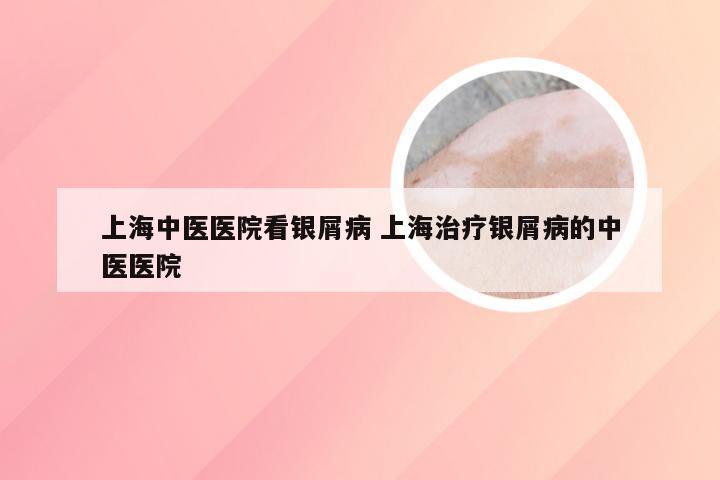 上海中医医院看银屑病 上海治疗银屑病的中医医院