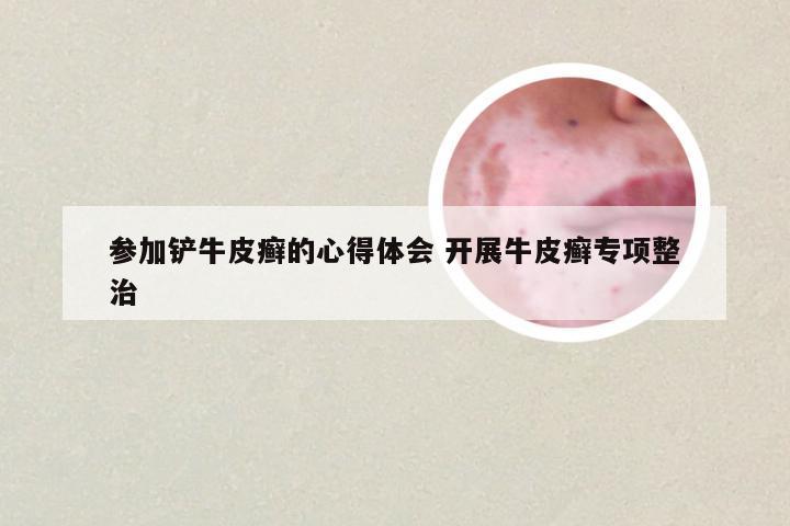 参加铲牛皮癣的心得体会 开展牛皮癣专项整治