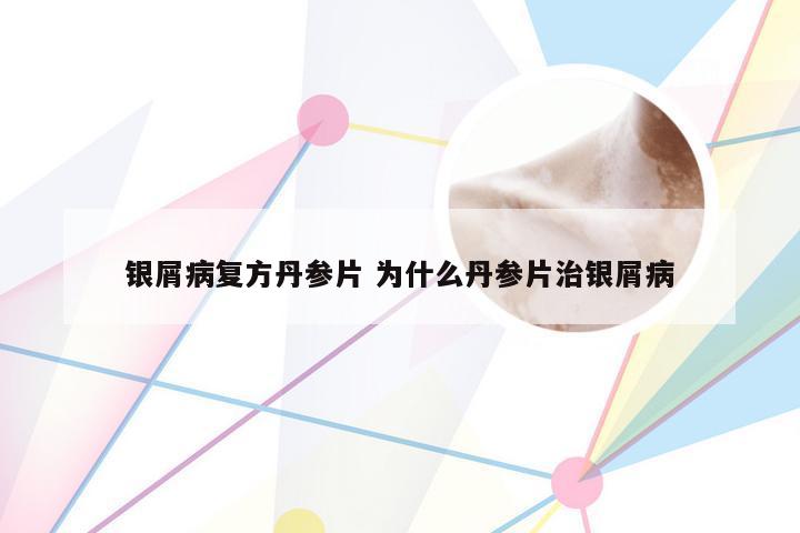 银屑病复方丹参片 为什么丹参片治银屑病